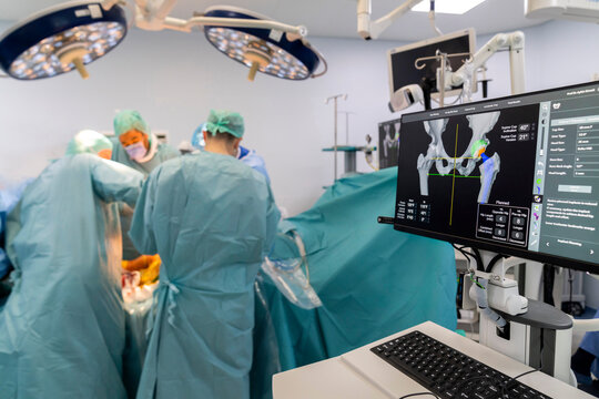 Team of doctor perform total hip arthroplasty replacement surgery in osteoarthritis patient inside the operating room. robot assisted robotic hip and knee replacement surgery	