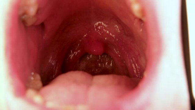 Inside wide open mouth exposing tong and throat flexing muscles.
