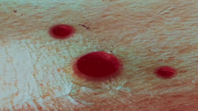 Outgrowth appears on skin surface. Acne or tumor 3D Abstract Render