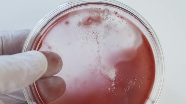 Bacteria culture growth on a petri dish in microbiology lab. Candida auris. Microbial cultures growth on selective media plate in microbiology laboratory. Biomarker. Bio-reagent. Fungus and mold.