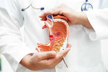 Stomach disease, doctor holding anatomy model for study diagnosis and treatment in hospital.