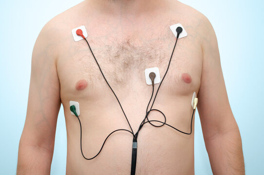 A man wearing holter monitor device