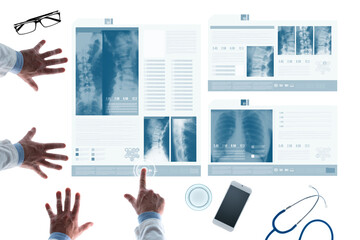 Professional medical team examining patient's medical records and x-ray on touch screen slides, a...
