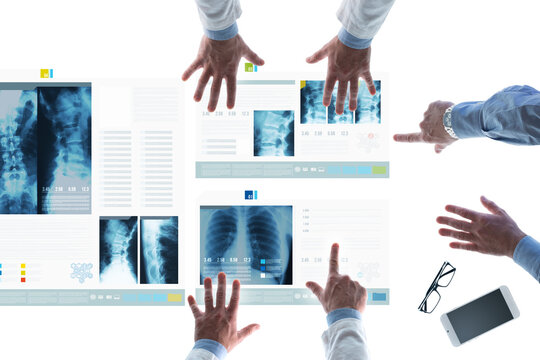 Professional medical team examining patient's medical records and x-ray on touch screen slides and pointing