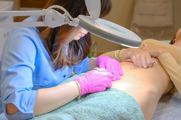 Young woman dermatologist doing hair removal treatment on patient's bikini zone with electrolysis