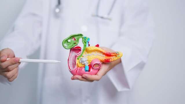 Doctor with human Pancreatitis anatomy model with Pancreas, Gallbladder, Bile Duct, Duodenum, Small intestine. Pancreatic cancer, Acute and Chronic pancreatitis,  Digestive system and Health concept