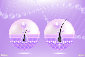 Hyaluronic acid before and after hair and skin solutions ad. purple collagen serum drop into skin cells with cosmetic advertising background ready to use, illustration vector.