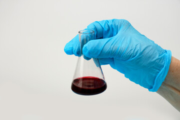 doctor's hand in a glove holds a test tube with blood
