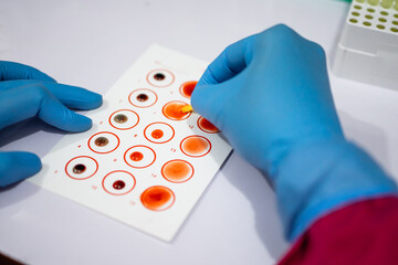 hands wearing rubber gloves mixing blood with serum when testing blood types in the lab