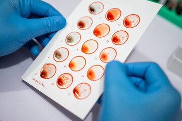 hand wearing rubber gloves holding test paper when testing blood types in the lab