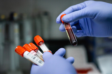 Gloved hands holding several bottles of blood ampoules with a laboratory background