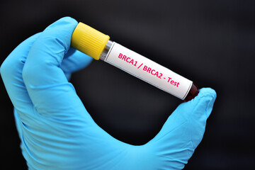 Blood sample for BRCA1 and BRCA2 test, gene marker for breast cancer