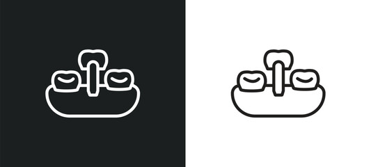overdenture outline icon in white and black colors. overdenture flat vector icon from dentist collection for web, mobile apps and ui.