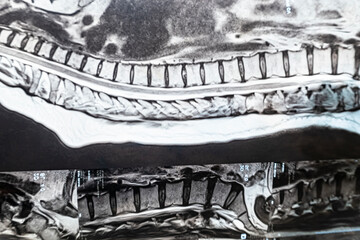 My spine MRI. Medical, science and education mri spine background. MRI scan film