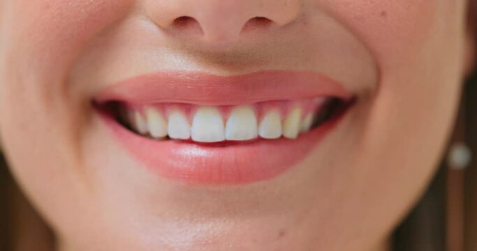 Happy, teeth and closeup smile of a woman for medical or dental health results. Mouth, wellness and lips and oral hygiene of a person or dentist patient showing progress of whitening or treatment
