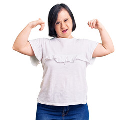 Brunette woman with down syndrome wearing casual white tshirt shouting with crazy expression doing rock symbol with hands up. music star. heavy music concept.