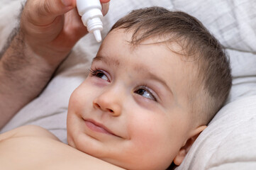 cute infant baby boy with purulent acute bacterial conjunctivitis lying on bed. puffy red eye,...