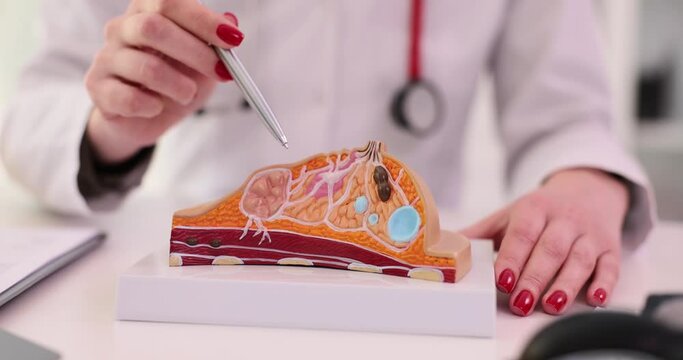 Female doctor explaining disease of mammary glands using an anatomical model of breast. Diseases of mammary glands causes prevention and treatment