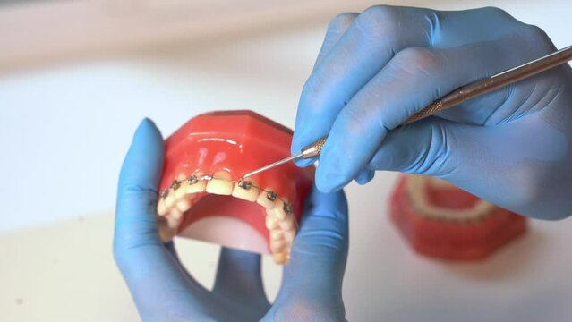 Close-up dentist hands in medical gloves hold plaster human jaw layout using plugger, describe therapy to patient. Oral hygiene orthodontic treatment