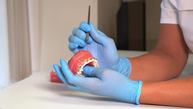 Close-up dentist hands in medical gloves hold plaster human jaw layout using plugger, describe therapy to patient. Oral hygiene orthodontic treatment