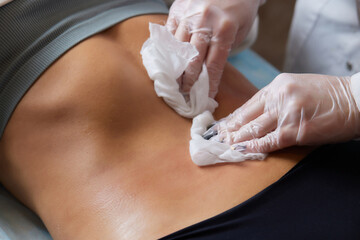 procedure removing cellulite on female abdomen, cavitation belly massage. Ultrasonic massage for...