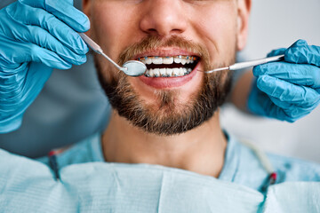 Cropped portrait of handsome man with braces sitting in dental chair. Doctor in gloves holding examination tools behind. Braces, alignment of teeth. - obrazy, fototapety, plakaty