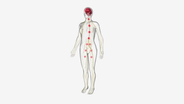 Central sensitization, the process by which the central nervous system processes pain and other sensory stimuli