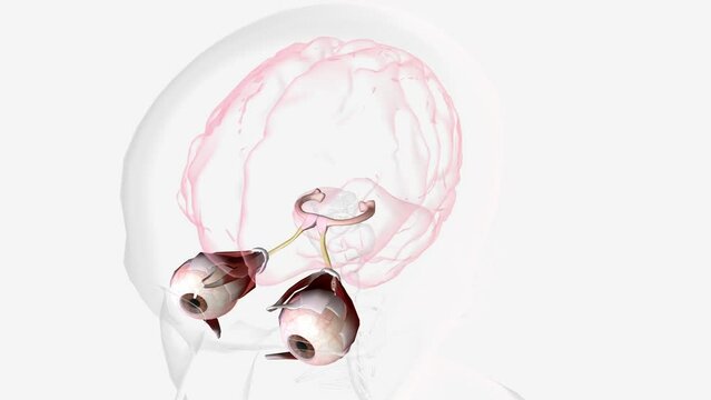 Strabismic Amblyopia Visual Pathway with Eye Movement