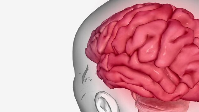 Central Sensitization Chronic pain