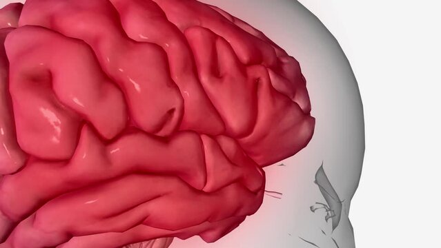 Central Sensitization Chronic pain