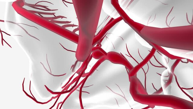 cerebral aneurysm is a weak or thin spot on an artery in the brain that balloons or bulges out and fills with blood