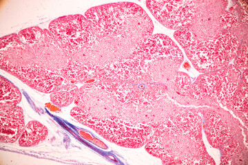 Showing Light micrograph of the Trachea, Thymus, Parathyroid gland and Tonsil  human under the...