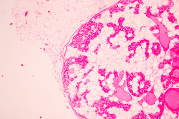 Showing Light micrograph of the Trachea, Thymus, Parathyroid gland and Tonsil  human under the microscope for education in the laboratory.