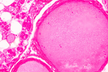 Obraz na płótnie Canvas Showing Light micrograph of the Trachea, Thymus, Parathyroid gland and Tonsil human under the microscope for education in the laboratory.
