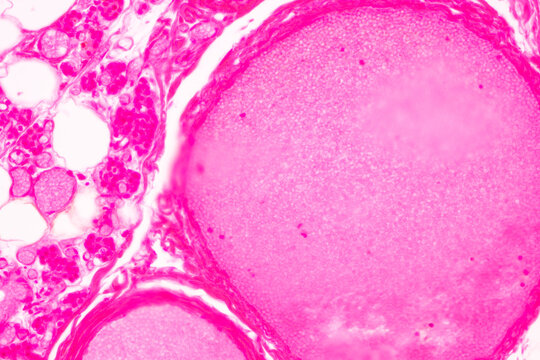 Showing Light micrograph of the Trachea, Thymus, Parathyroid gland and Tonsil  human under the microscope for education in the laboratory.