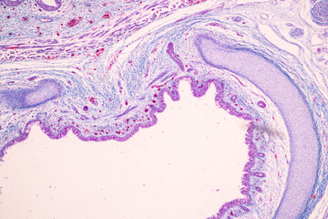 Showing Light micrograph of the Trachea, Thymus, Parathyroid gland and Tonsil  human under the microscope for education in the laboratory.