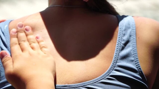 Woman sunblock shoulder. Close up on hand of happy smiling young woman is applying sunscreen or sun tanning lotion on a back. Take care of skin on a seaside beach during holidays vacation.