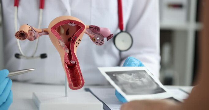 Anatomical model of the female reproductive system, close-up. Consultation with a gynecologist, ultrasound of the uterus