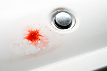 Blood clot in the sink. Problem with gums