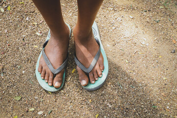 Feet of poor kid wearing dirty shoes standing