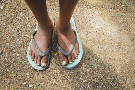 Feet of poor kid wearing dirty shoes standing