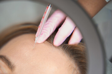 Doctor makes beauty injections to woman in the frontal zone