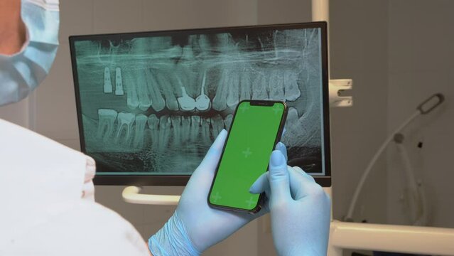 Closeup dentist hands sterile glove hold green screen cellphone at dentistry office over teeth xray on monitor. Orthodontist scroll smartphone chroma key screen mockup template on display for teeth.