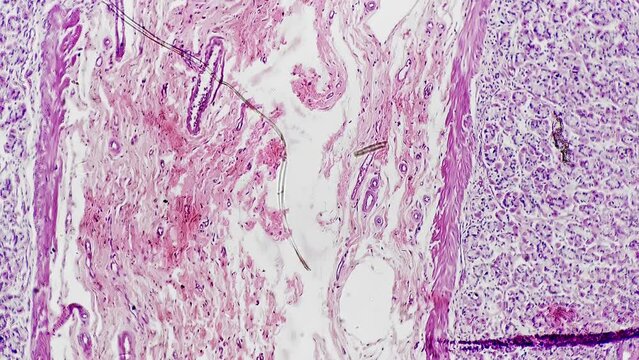 Slide with pattern of human stomach in section studied in lab under microscope 200x on bright field. High magnification on people organ of digestive system to examine structure and find dangerous cell