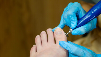 Hardware pedicure. Foot and toe treatment