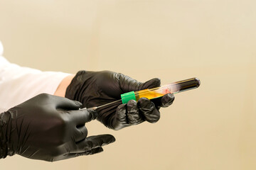 Platelet-Rich Plasma for injection