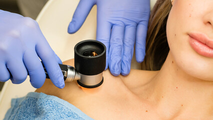 Dermatologist examines moles and birthmarks