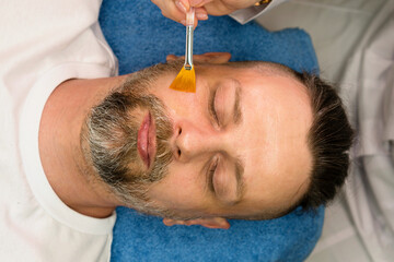 Face peeling procedure for man