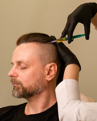 PRP therapy and plasma lift treatment
