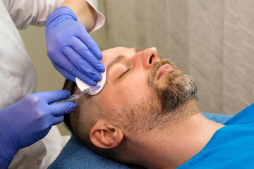 Fototapeta premium Mesotherapy rejuvenation injection for man